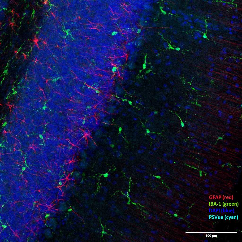 Fig 3. Example of overlapping image (of a male sham specimen) containing all stains used in protocol. (note: no PSVue positive cells depicted) Fig 3. Example of overlapping image (of a male sham specimen) containing all stains used in protocol. (note: no PSVue positive cells depicted)