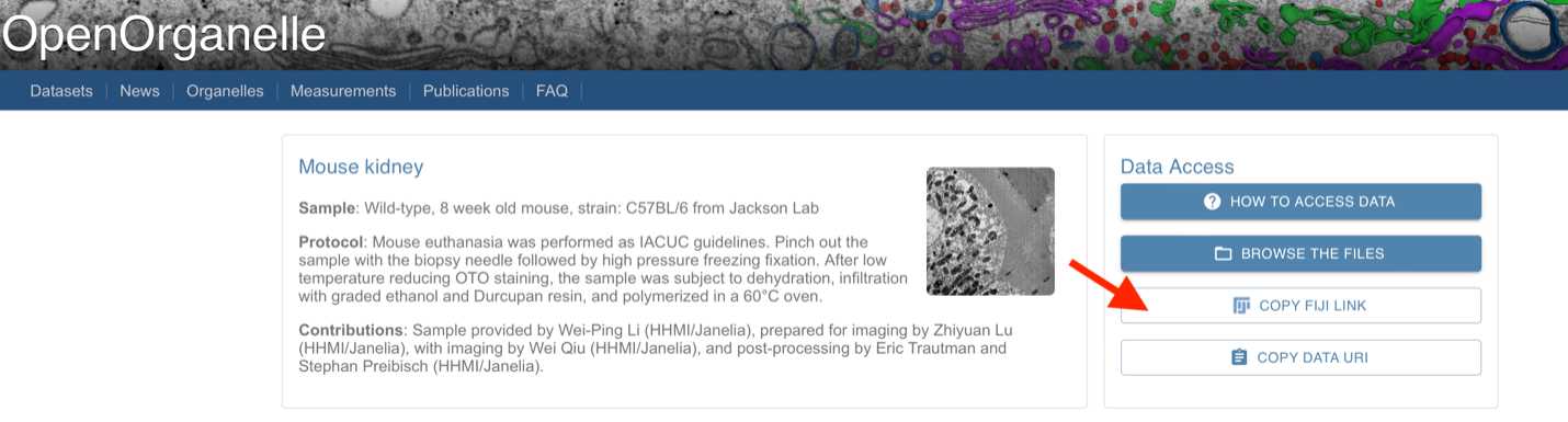 Figure 1: OpenOrganelle page. The Fiji link is located on the right-hand side. Figure 1: OpenOrganelle page. The Fiji link is located on the right-hand side.