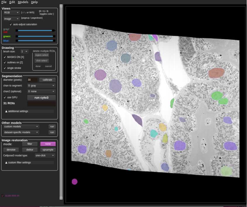 Figure 6: Example of a fully annotated slice from the dataset jrc_mus-kidney-2. Figure 6: Example of a fully annotated slice from the dataset jrc_mus-kidney-2.