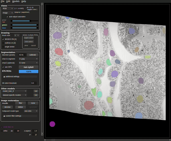 Figure 8: A finetuned Cellpose model has been applied to the dataset jrc_mus-kidney-2. Figure 8: A finetuned Cellpose model has been applied to the dataset jrc_mus-kidney-2.
