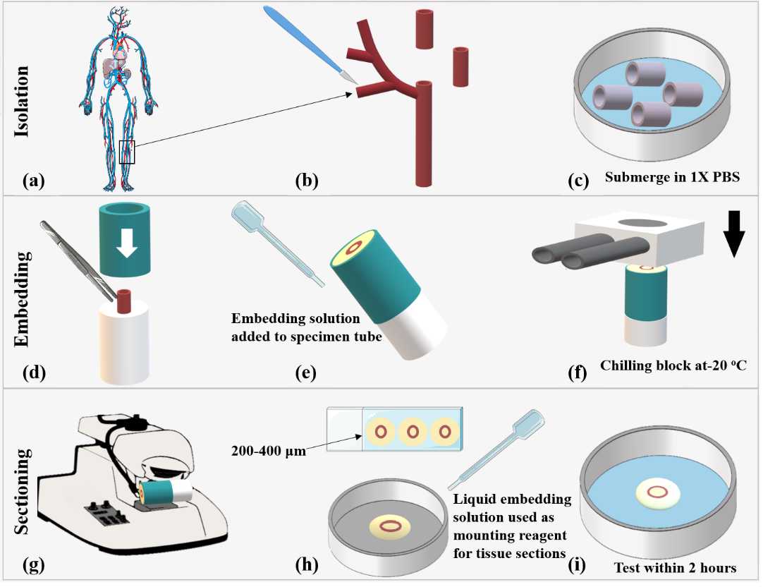 Figure 3 Example of tissue preparation, embedding and sectioning for microindentation using human vascular tissue. (a) Human tissue is obtained on the day of surgery. (b) A region of tissue is isolated and cut to approximately 10 mm2 for microindentation. (c) Samples are hydrated in 1X PBS and placed on ice for approximately 10 minutes prior to embedding. (d) The tissue segment is glued to the white specimen tube and allowed to dry for 1 minute. The metal specimen tube is placed onto the white specimen tube once the glue is dry. (e) The agarose and gelatin embedding solution is added to the specimen tube. (f) The filled specimen tube is rapidly cooled with a chilling block or on ice for approximately 1 minute. (g) The cooled specimen tube is mounted into the vibratome. (h) The tissue is sectioned to the desired thickness. (i) The tissue section is mounted onto the liquid agarose and gelatin embedding solution. The tissue is hydrated in 1X PBS before microindentation Parts of the figure were reprinted from Servier Medical Art under CC BY icence (https://creativecommons.org/licenses/by/4.0/deed.en) with permission from Servier, original copyright 2023. Figure 3 Example of tissue preparation, embedding and sectioning for microindentation using human vascular tissue. (a) Human tissue is obtained on the day of surgery. (b) A region of tissue is isolated and cut to approximately 10 mm2 for microindentation. (c) Samples are hydrated in 1X PBS and placed on ice for approximately 10 minutes prior to embedding. (d) The tissue segment is glued to the white specimen tube and allowed to dry for 1 minute. The metal specimen tube is placed onto the white specimen tube once the glue is dry. (e) The agarose and gelatin embedding solution is added to the specimen tube. (f) The filled specimen tube is rapidly cooled with a chilling block or on ice for approximately 1 minute. (g) The cooled specimen tube is mounted into the vibratome. (h) The tissue is sectioned to the desired thickness. (i) The tissue section is mounted onto the liquid agarose and gelatin embedding solution. The tissue is hydrated in 1X PBS before microindentation Parts of the figure were reprinted from Servier Medical Art under CC BY icence (https://creativecommons.org/licenses/by/4.0/deed.en) with permission from Servier, original copyright 2023.