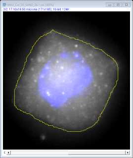 This example image demonstrates how heterogeneous background labelling makes thresholding essential for determining quantitative mRNA data. (The mRNA probe channel is presented in a grey scale and blue indicates the nucleus stained with DAPI) This example image demonstrates how heterogeneous background labelling makes thresholding essential for determining quantitative mRNA data. (The mRNA probe channel is presented in a grey scale and blue indicates the nucleus stained with DAPI)