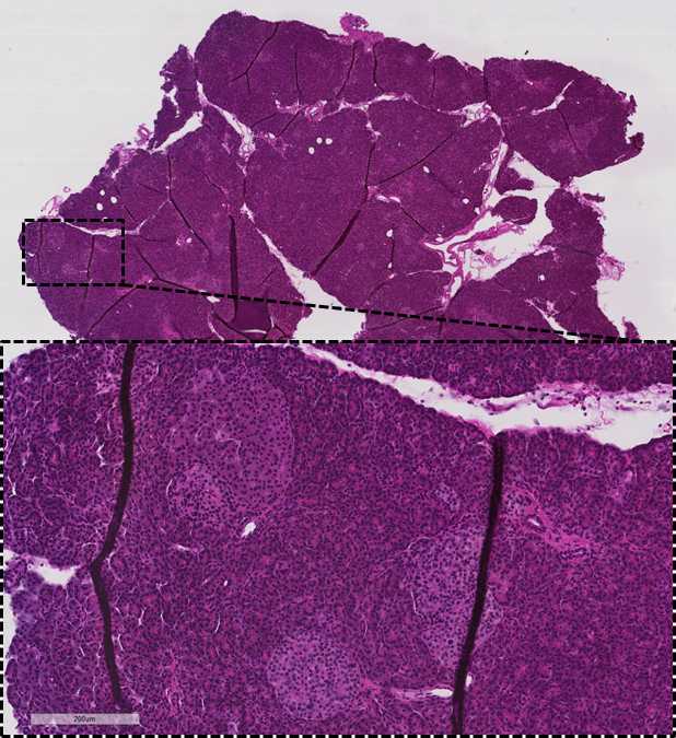 Figure 1. H&E stained pancreas with magnified section showing nuclei in blue and cytoplasm in pink. Figure 1. H&E stained pancreas with magnified section showing nuclei in blue and cytoplasm in pink.