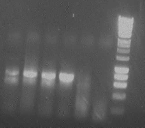 example of four PCR products with one negative control on the right. HyperLadder™ 1kb as the molecular weight marker. example of four PCR products with one negative control on the right. HyperLadder™ 1kb as the molecular weight marker.