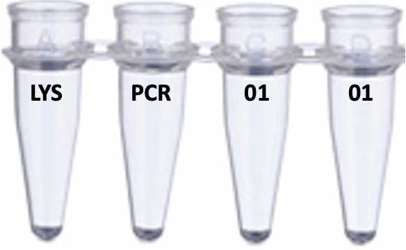 Here we have labelled tubes 1 and 2 with LYS and PCR because that is where we will place the DNA extraction liquid and the PCR mix, respectively. As an example, this student was assigned sequencing identifier 01 (you will probably be assigned a different identifier) Here we have labelled tubes 1 and 2 with LYS and PCR because that is where we will place the DNA extraction liquid and the PCR mix, respectively. As an example, this student was assigned sequencing identifier 01 (you will probably be assigned a different identifier)